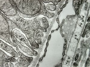 normal kidney - mouse(endothelium and podocyte) normal kidney - mouse(endothelium and podocyte)